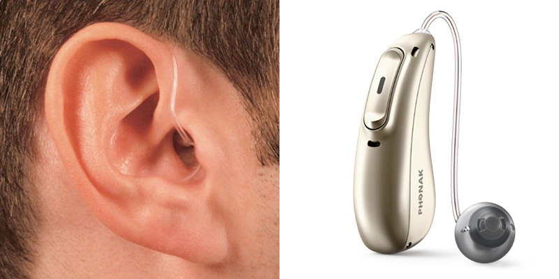 Receiver-in-the-ear (RITE)